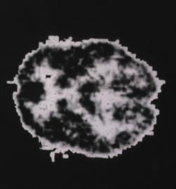Caption: PET scan from a former opioid addict under the influence of morphine, circa 1980., Credit: Image courtesy of the National Library of Medicine.