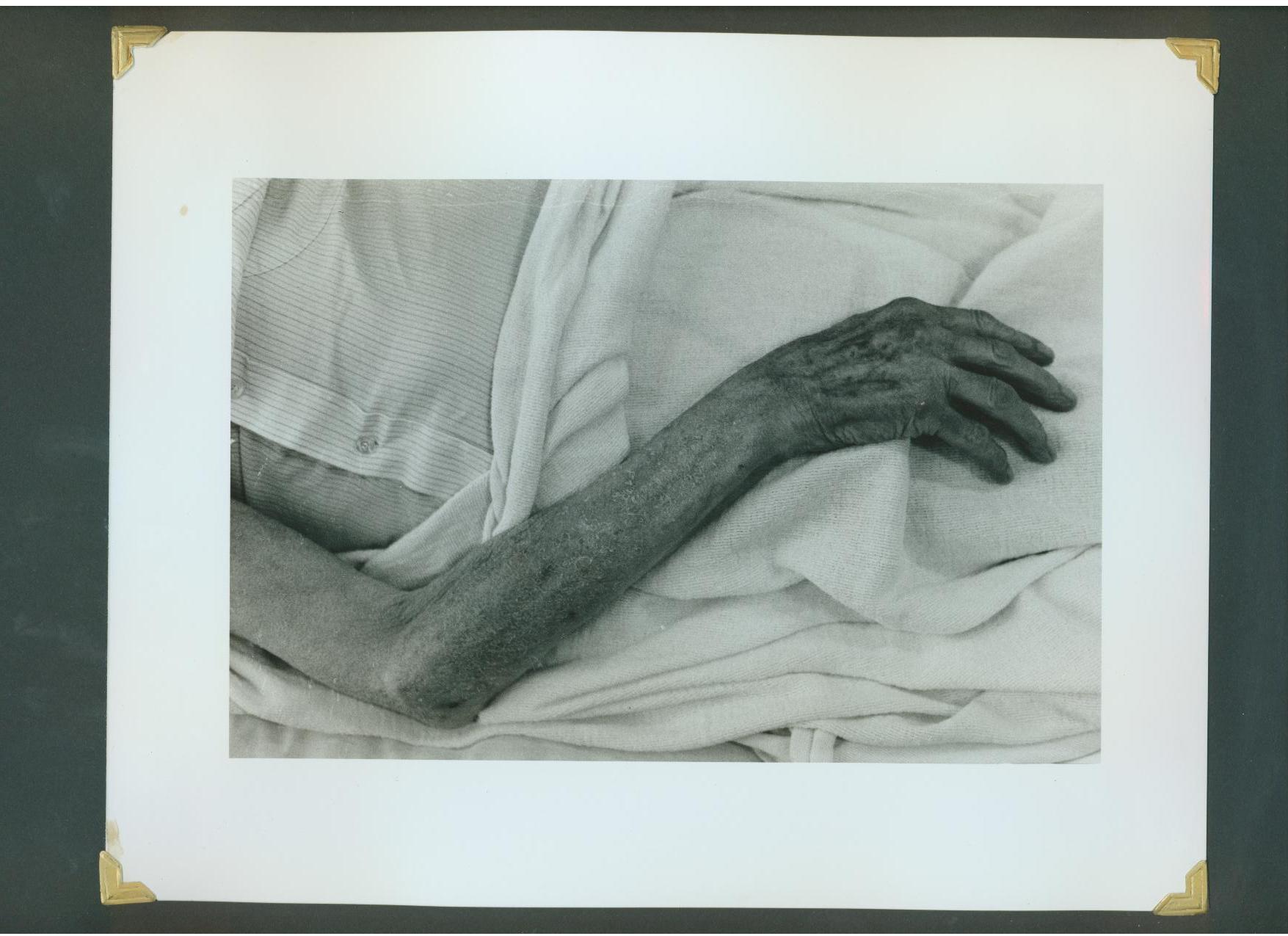 Piece image
