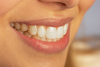 Cosmetic_dentistry_jefferson_city_mo