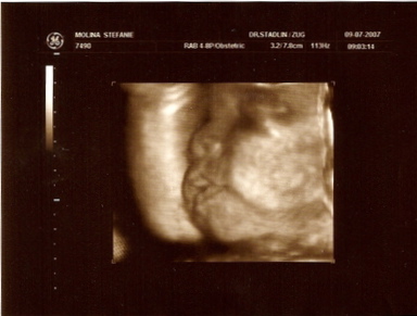 Baby-scan