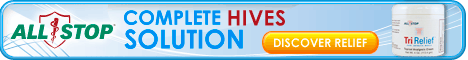 Hives Solution