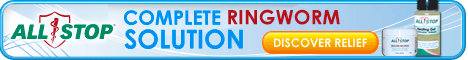 Sponsored Ad - Complete Ringworm Solution