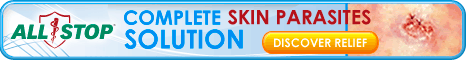 Complete Skin Parasites Solution