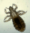 Head Lice Head Lice