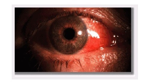 Par les bleus pris de rage et de nos yeux rouges on regarde les ...