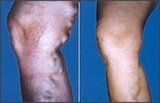 CIRUGIA GENERAL, DE URGENCIA Y LAPAROSCOPICA EN LIMA, PERU.