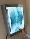 DIPLOMADO DE QUIROPRACTICA Y OSTEOPATIA A DISTANCIA O PRESENCIAL