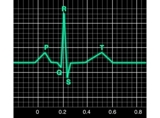 Aprenda Electrocardiografia(Estudiantes de medicina)