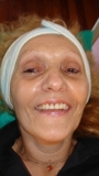 Cejas_antes_thumb