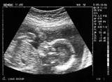 MOTIVOS DEL POR QUE NO SE DEBE LEGALIZAR EL ABORTO