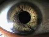 IRIDOLOGIA Cursos PROFESIONALES CON CERTIFICACION INTERNACIONAL