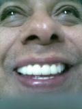 Ozonoterapia Dental Alanis 