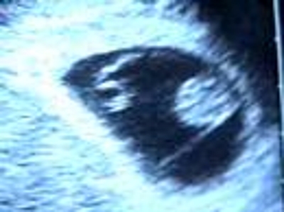 MÁNCORA- CONSULTORIO MÉDICO FLORES BUISSON. RATING VIDEOS PROPIOS, MÁNCORA - PERÚ