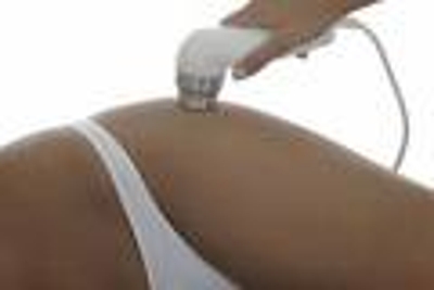celulitis, estrias, secuela de acne, peeling, flacidez, ojeras, 