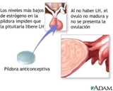MÁNCORA - CONSULTORIO MÉDICO FLORES - MÉTODOS ANTICONCEPTIVOS N:1 