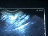CONSULTORIO MÉDICO FLORES BUISSON- MÁNCORA- RATING VIDEOS AL 9/X/08