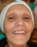 Liliantes_thumb