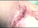 MÁNCORA- CONSULTORIO MÉDICO FLORES BUISSON- RATING VIDEOS 27/X/2008