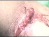 MÁNCORA- CONSULTORIO MÉDICO FLORES BUISSON- VIDEOS,RATING 18/11/08 - Piura - Piura