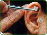 ACUPUNTURA AURICULAR ESTETICA - AUXILIO NA REDUÇÃO DE MEDIDAS