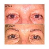 CURSO DE MAQUILLAJE PERMANENTE (DERMOPIGMENTACION)