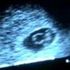 MÁNCORA- CONSULTORIO MÉDICO FLORES BUISSON- VIDEOS AL 16/Marzo/2009 - Piura - Piura