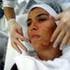 Estetica Facial>Limpeza de Pele Tratamentos Com Peeling Quimico