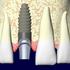 PORTAL IMPLANTE DENTÁRIO | CLINICAS ESPECIALIZADAS EM SÃO PAULO