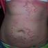 Medico Dermatologo - Dr. JuanJose Fajardo B- Dermatologia Natural - Lima Metropolitana y Callao - Lima