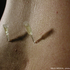 DISPOSITIVO DESECHABLE para Mesoterapia ACUPUNTURA/*MESOPUNTURA   