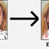 ACNE, TRATAMIENTO PARA EL ACNE, ELIMINALO PARA SIEMPRE