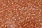 Goldstone