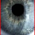The_eye