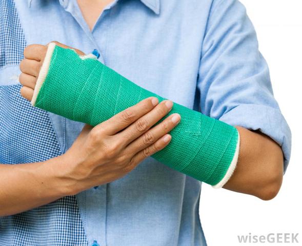 Broke My Arm 2nd Time Timeline Timetoast Timelines