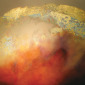 Ovum 2