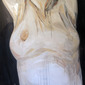 A sick body