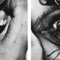 SPIT