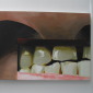 Ear, nose and teeth