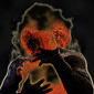 Ignite