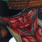 Musicman  - IV. Strongman
