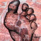 Heel