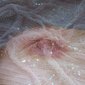 Poetry of a Nipple