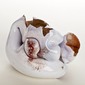 collapsed heart2
