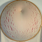 Sally Hewett