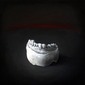 With Teeth (elder no. 2)