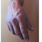 Mano rodilla