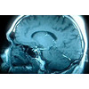 Brain_large
