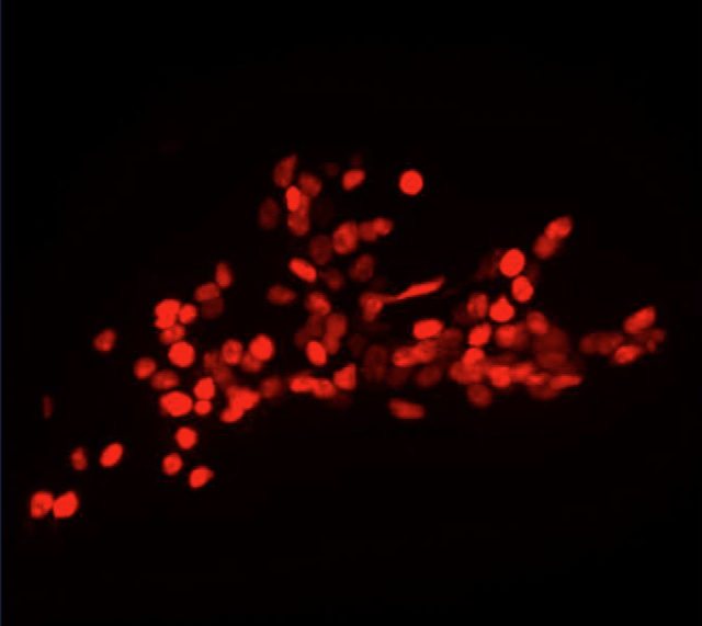 Andrew Leifer and collaborators can capture activity from more than 100 neurons in the worm brain. Credit: Leifer lab