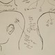 Autopsy Drawing of Linda Stein's Skull(Office of the Chief Medical Examiner)