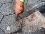 Man Beaten With His Own Crutches in Lower East Side Park